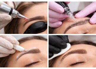 Is Eyebrow Tattoo Removal Worth It? Eyebrow Tattoo Removal